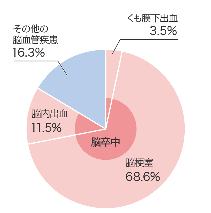 脳梗塞:68.6%、脳内出血:11.5%、くも膜下出血:3.5%(以上が脳卒中を構成)、その他の脳血管疾患:16.3%